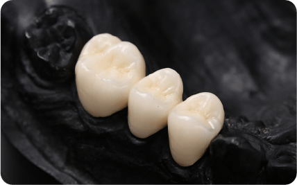 セラミックの被せ物