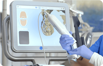 インビザライン(マウスピース矯正)に使用する光学スキャナー(iTero)の使用風景