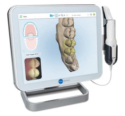 インビザライン(マウスピース矯正)に使用する光学スキャナー(iTero)