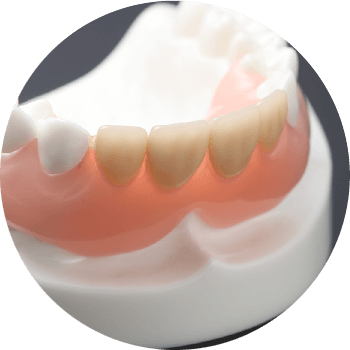 ノンクラスプ義歯(金属のバネがない入れ歯)