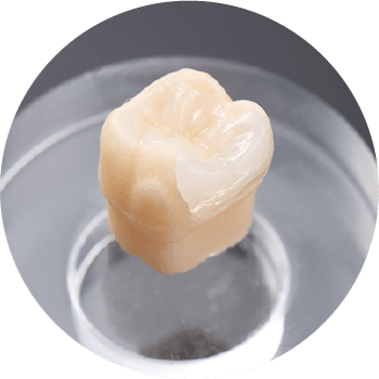 オールセラミックス(e-MAX)