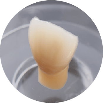 ハイブリッド
(セラミックスとプラスチックの中間素材)