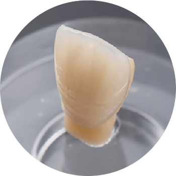 ラミネートべニア