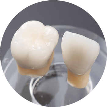 メタルボンド
(金属にセラミックスを焼き付けたもの)