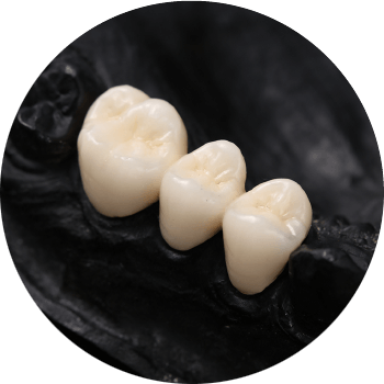 ジルコニアブリッジ